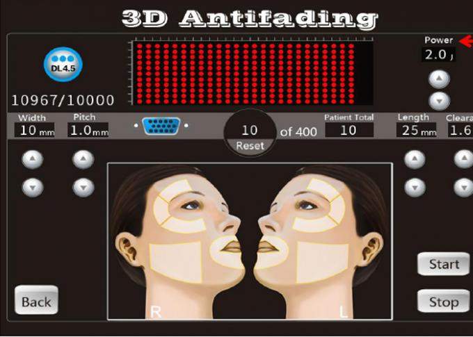 1-11の20000の打撃3D Hifuの改築機械8カートリッジは並びます