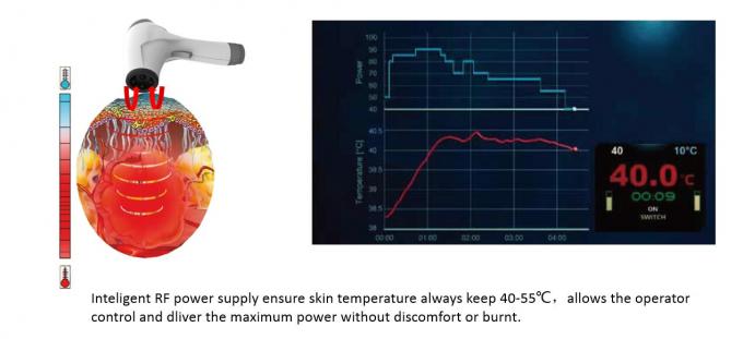 最高に80W美の表面持ち上がる機械Rf Thermoliftレーザーの皮のきつく締まること