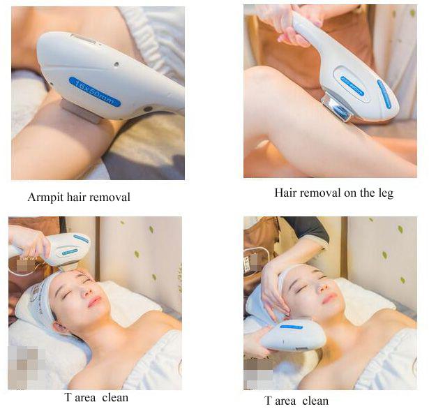 EpiMEDの新しい設計多機能のbuleの毛の取り外しの美機械/レーザー取り外し機械