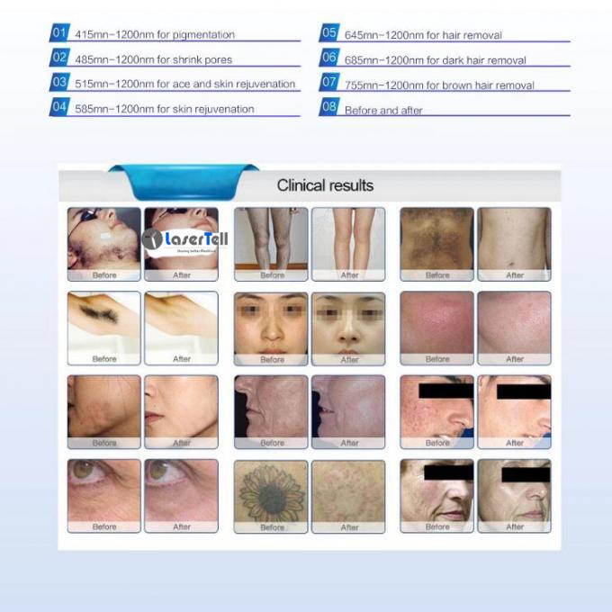 EpiMEDの新しい設計多機能のbuleの毛の取り外しの美機械/レーザー取り外し機械